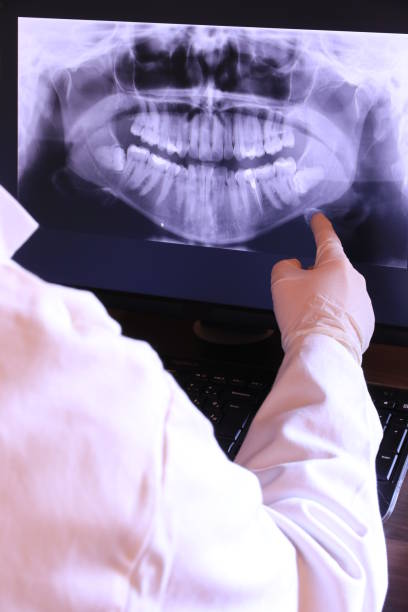 Best Emergency Root Canal Treatment in Brookville, IN