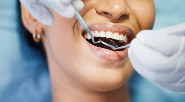 Best Urgent Care for Lost Fillings or Crowns in Brookville, IN