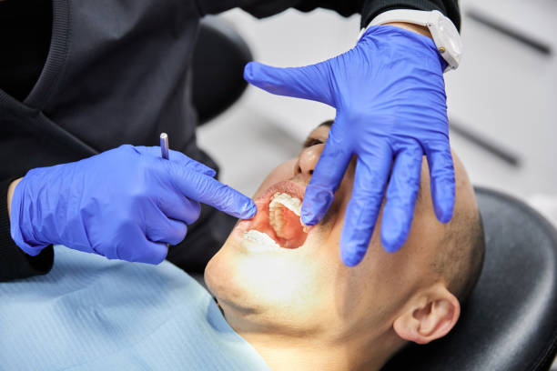 Best Emergency Dental Care for Broken or Chipped Teeth in Brookville, IN