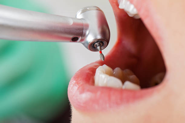 Best Pediatric Emergency Dentist in Brookville, IN
